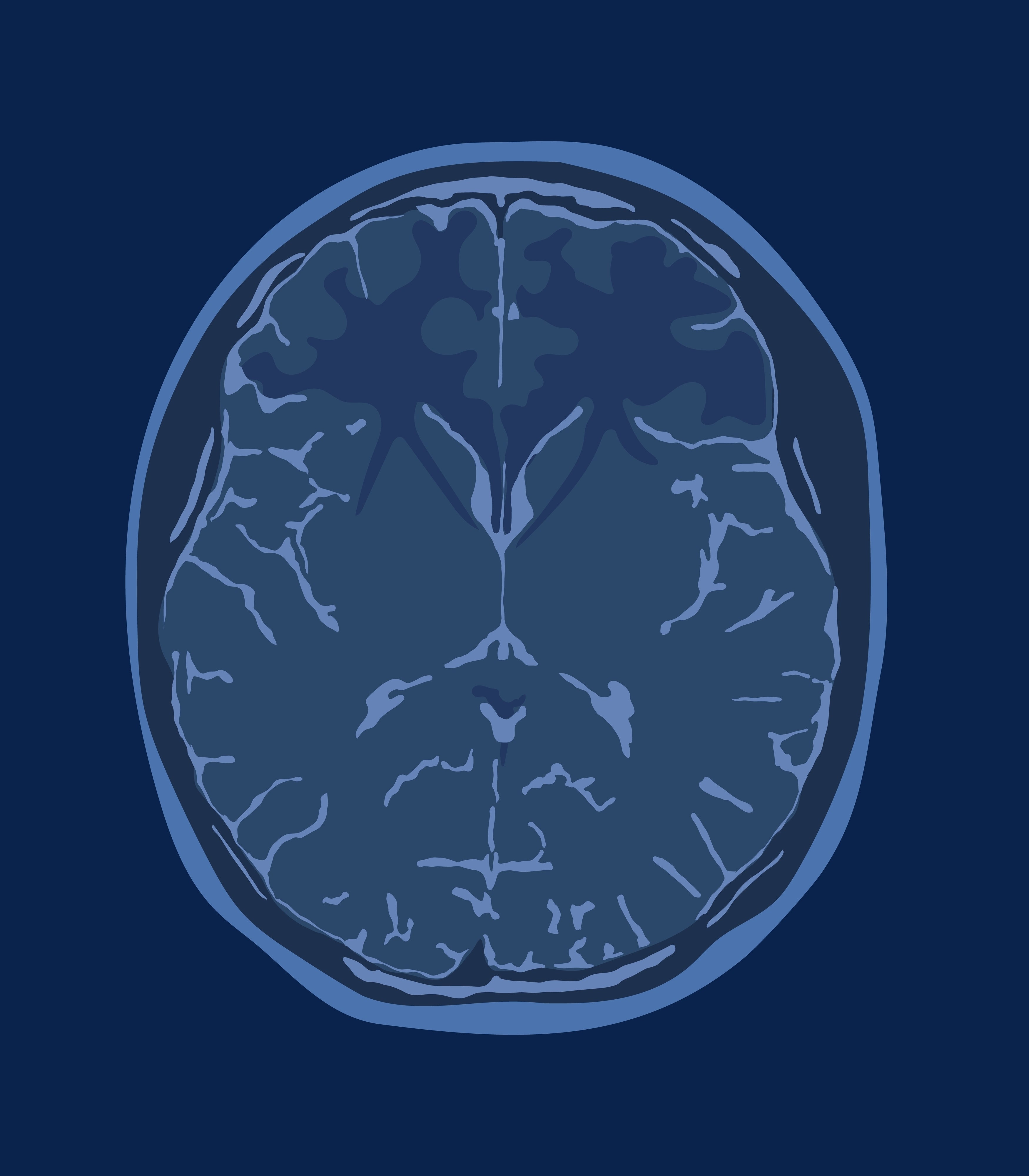 Illustration graphic of a brain showing intersecting neural pathways