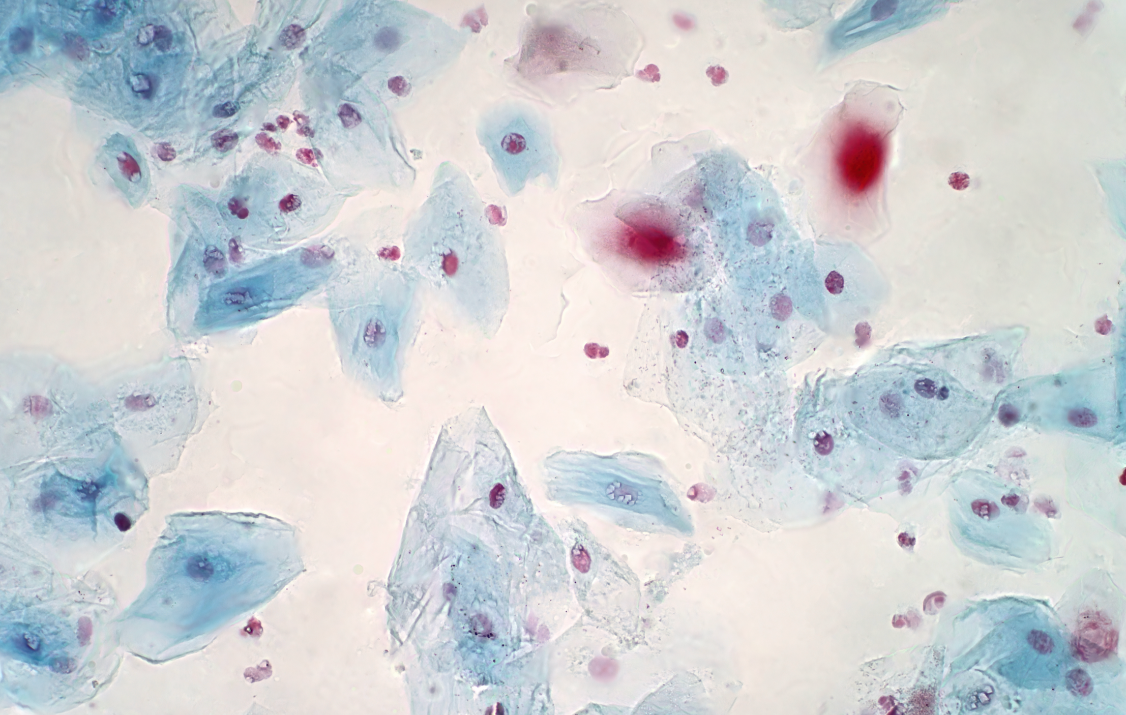 Image of oral cheek cell under microscope