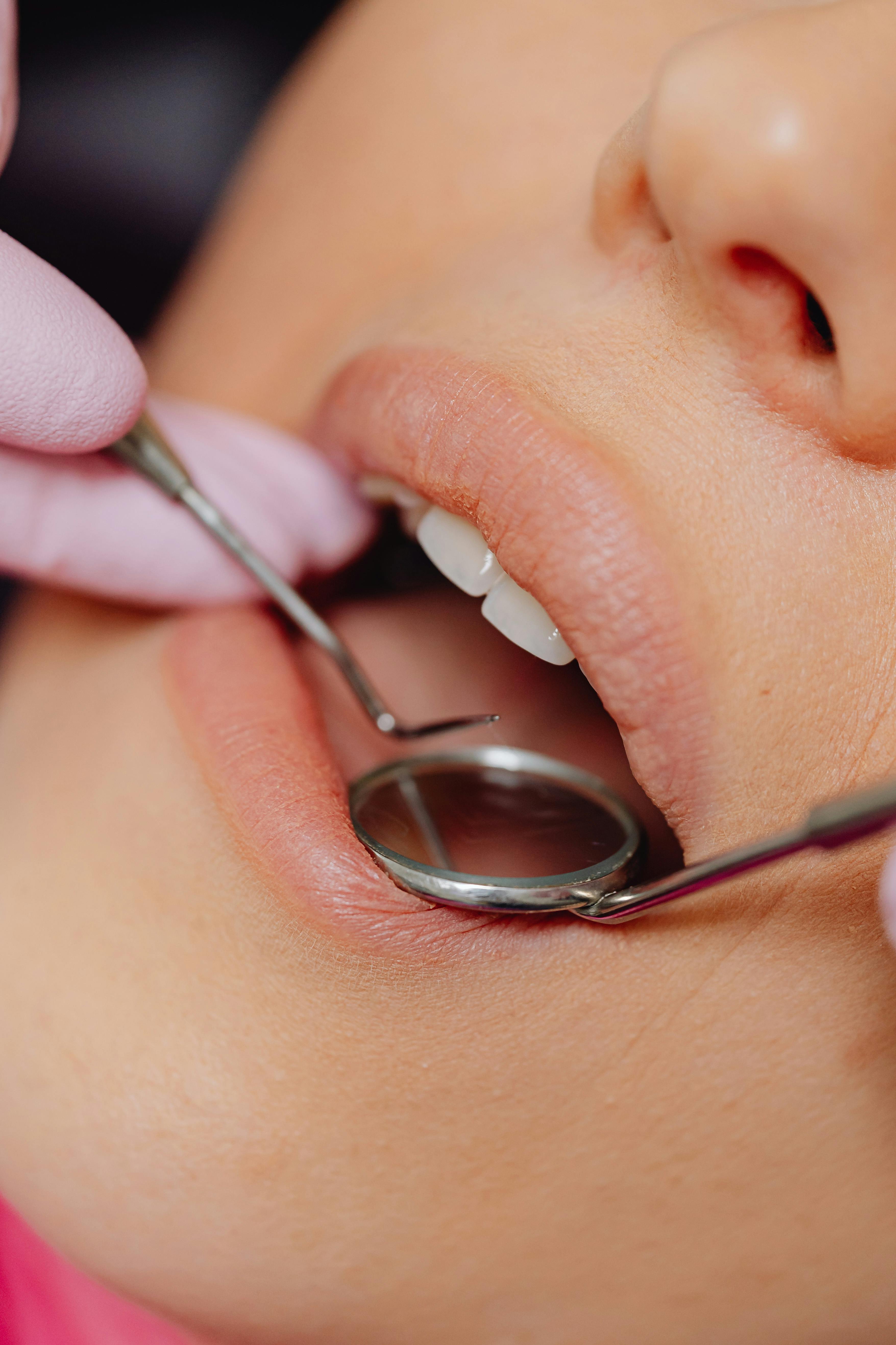 A patient checking her oral health and teeth by the dentist with tools like a mouth mirror and probes