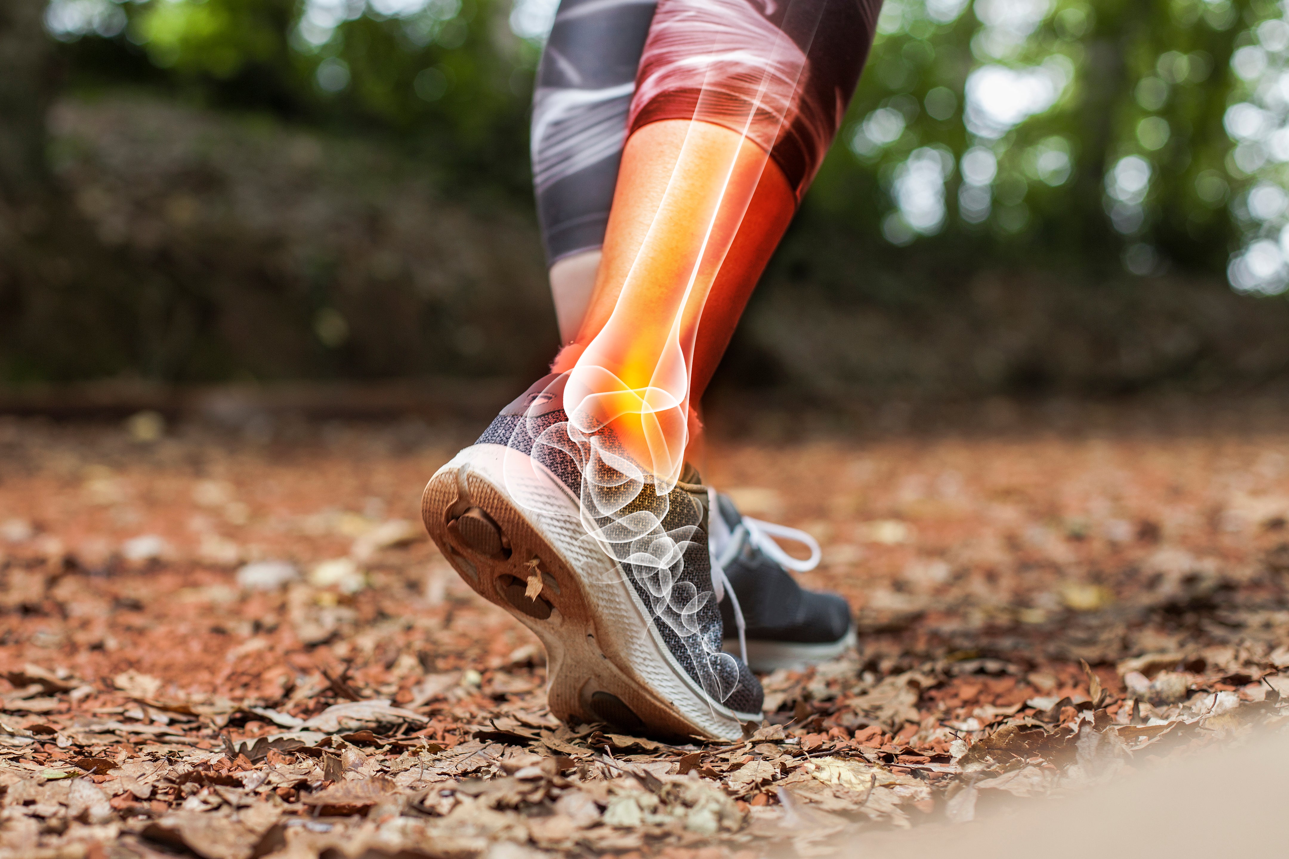 Illustration of the tibia and fibula bones of the leg in motion, representing running or sports activity