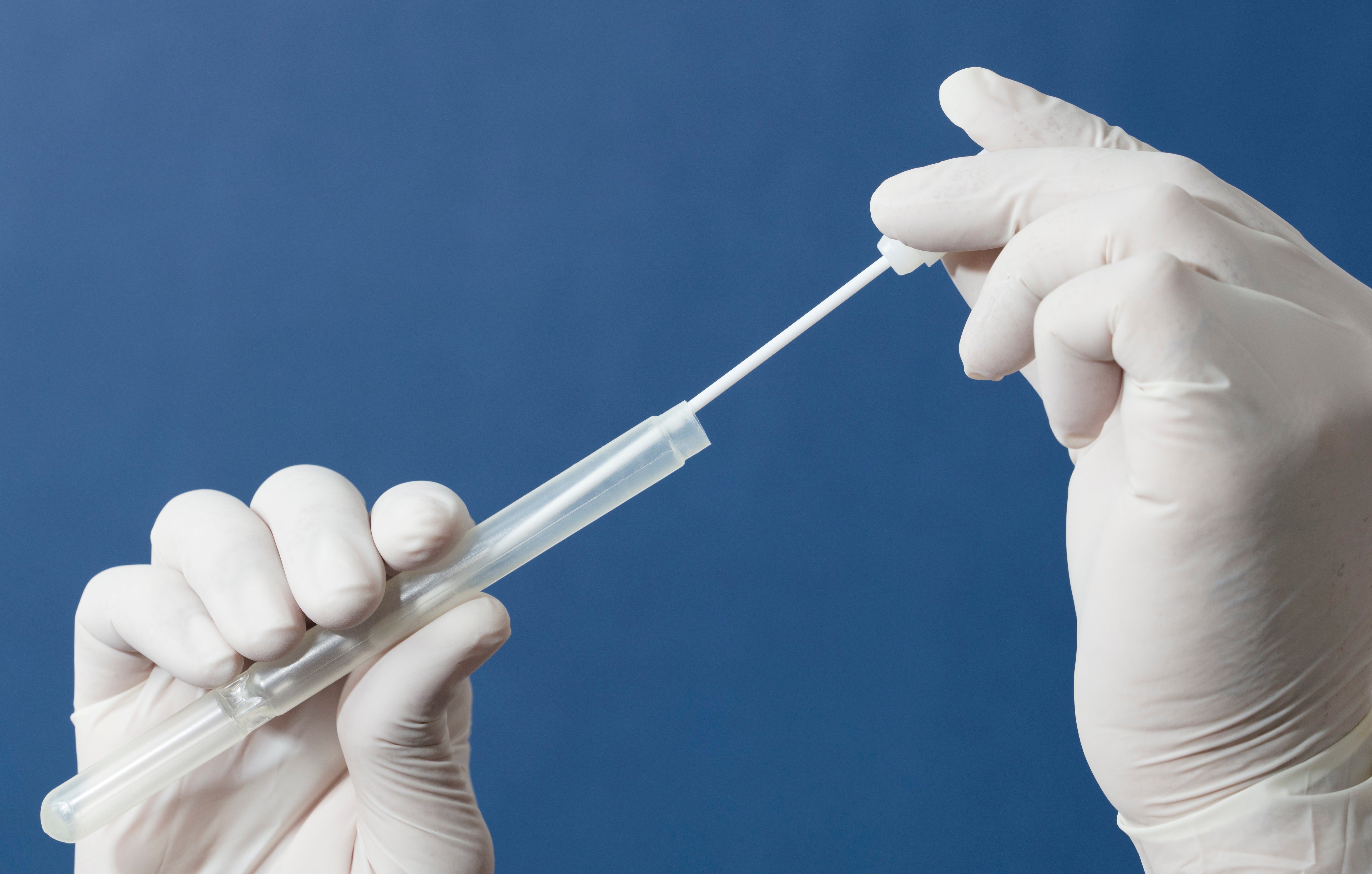 Example of how a swab test looks like