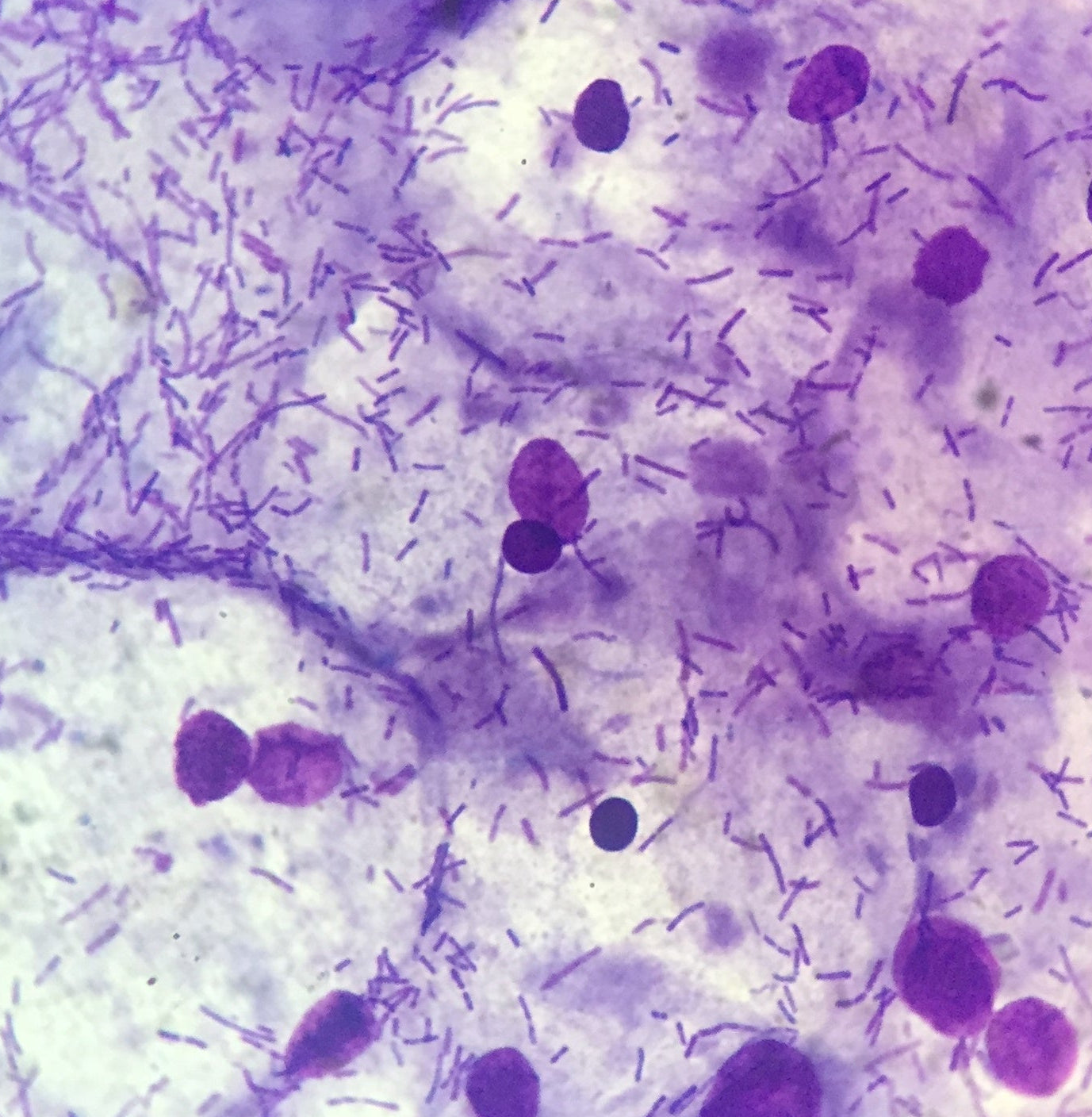 Microscopic view of vaginal cells and bacteria under a microscope with purple and white colours.